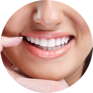 Cosmetic Veneers Las Cruces NM